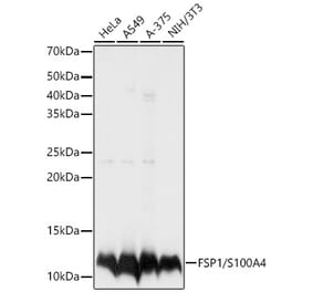 Western Blot - Anti-S100A4 Antibody (A13562) - Antibodies.com