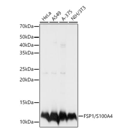 Western Blot - Anti-S100A4 Antibody (A13562) - Antibodies.com