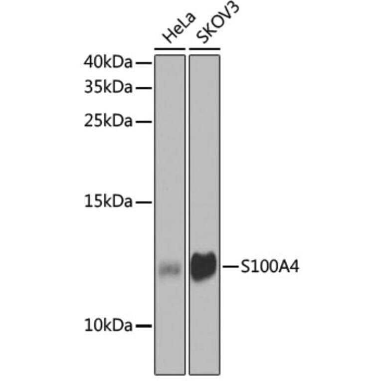 Western Blot - Anti-S100A4 Antibody (A1631) - Antibodies.com