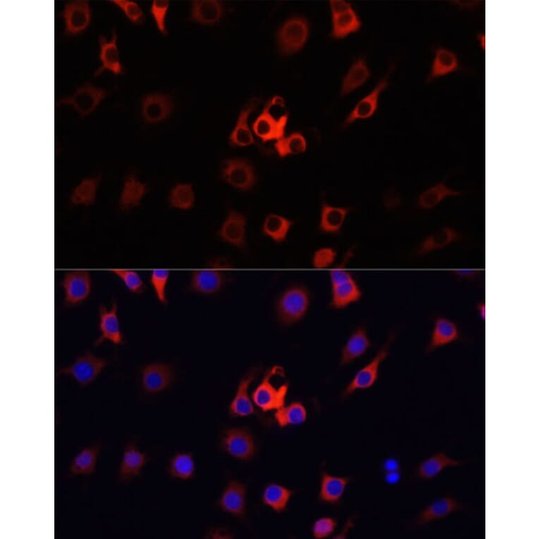 Immunofluorescence - Anti-S100A4 Antibody (A1631) - Antibodies.com