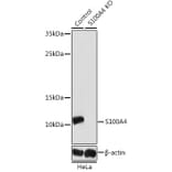 Western Blot - Anti-S100A4 Antibody (A1631) - Antibodies.com