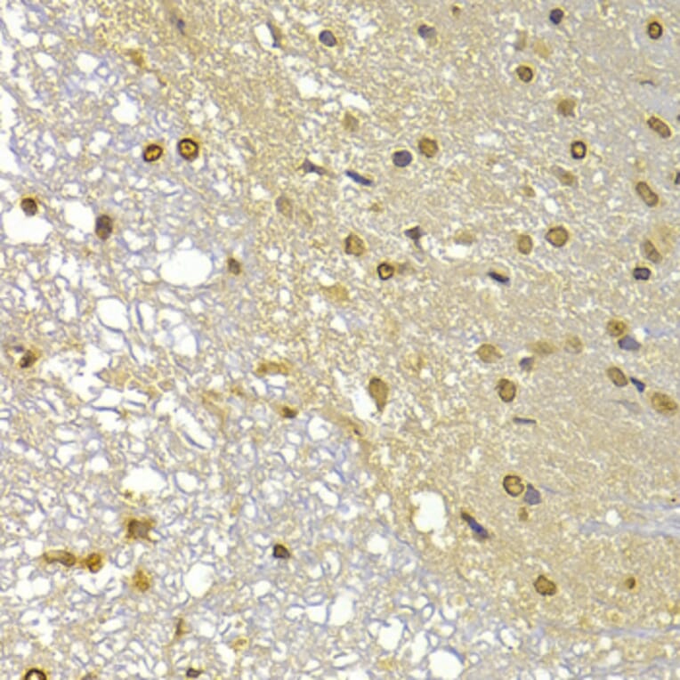 Immunohistochemistry - Anti-S100A4 Antibody (A1631) - Antibodies.com