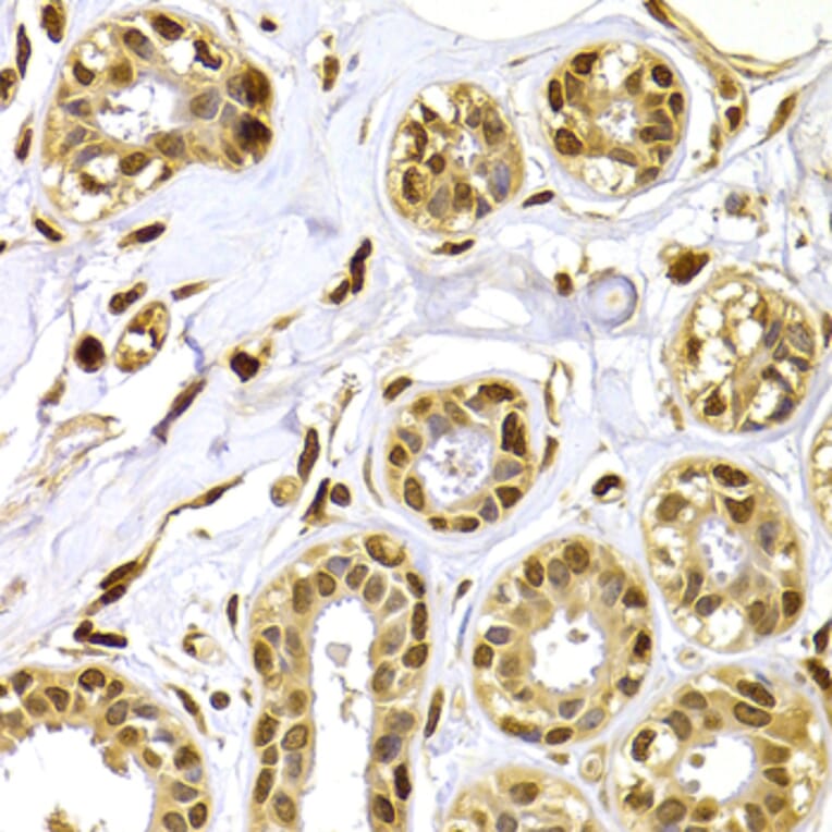 Immunohistochemistry - Anti-S100A4 Antibody (A1631) - Antibodies.com