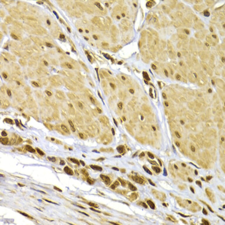 Immunohistochemistry - Anti-S100A4 Antibody (A1631) - Antibodies.com