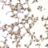 Immunohistochemistry - Anti-S100A4 Antibody (A1631) - Antibodies.com