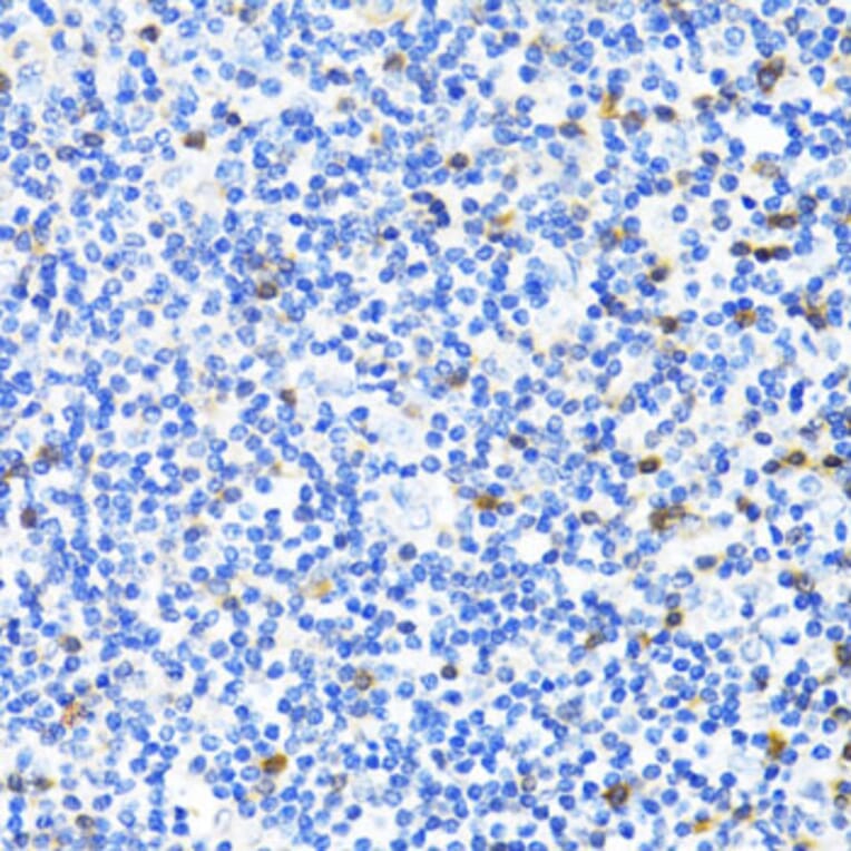 Immunohistochemistry - Anti-S100A4 Antibody (A1631) - Antibodies.com