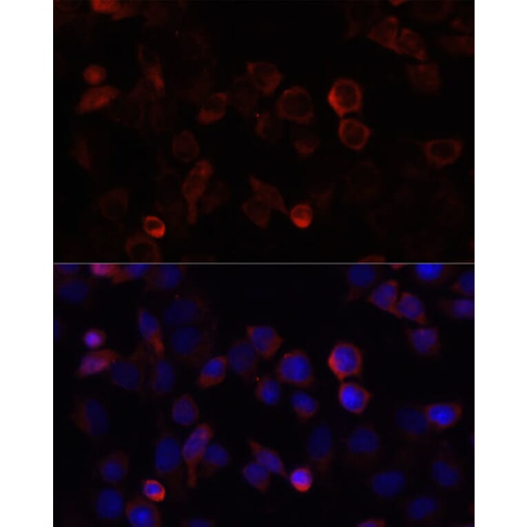 Immunofluorescence - Anti-S100A4 Antibody (A1631) - Antibodies.com