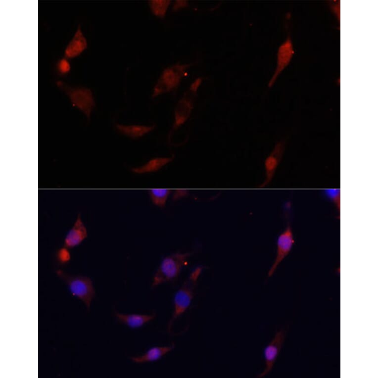 Immunofluorescence - Anti-S100A4 Antibody (A1631) - Antibodies.com