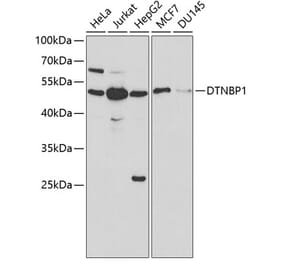 Western Blot - Anti-Dysbindin Antibody (A13563) - Antibodies.com