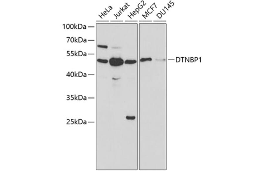 Western Blot - Anti-Dysbindin Antibody (A13563) - Antibodies.com