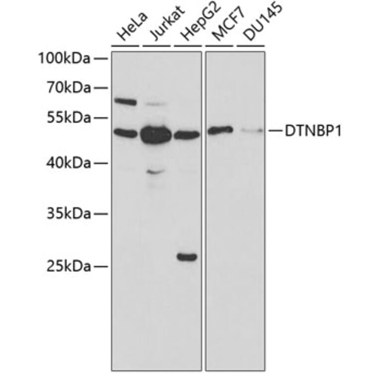 Western Blot - Anti-Dysbindin Antibody (A13563) - Antibodies.com