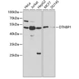 Western Blot - Anti-Dysbindin Antibody (A13563) - Antibodies.com