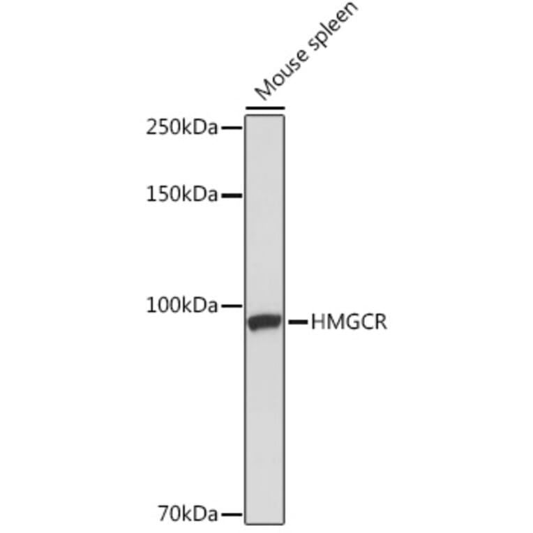 Western Blot - Anti-HMGCR Antibody (A13564) - Antibodies.com