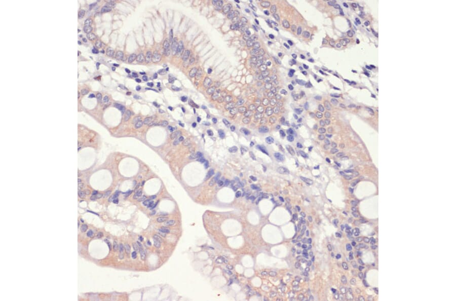 Immunohistochemistry - Anti-HMGCR Antibody (A13564) - Antibodies.com
