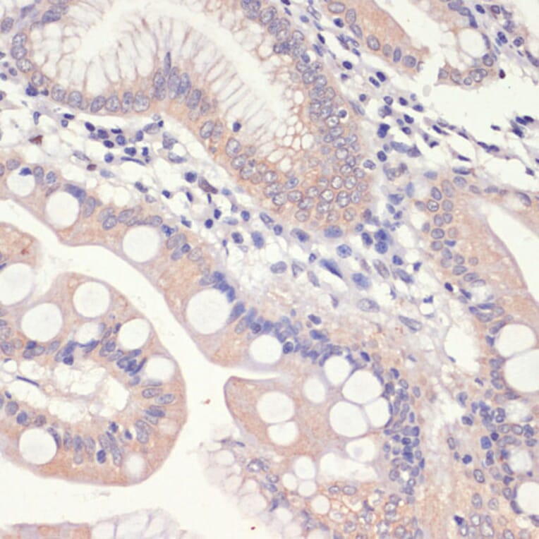 Immunohistochemistry - Anti-HMGCR Antibody (A13564) - Antibodies.com