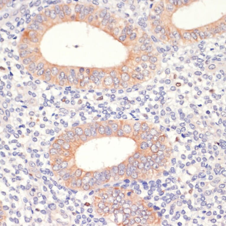 Immunohistochemistry - Anti-HMGCR Antibody (A13564) - Antibodies.com