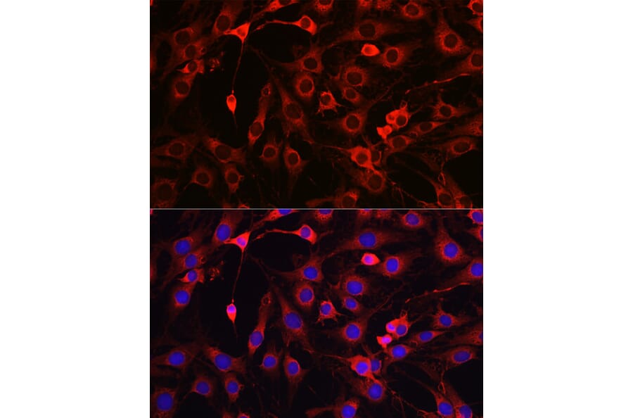 Anti-HMGCR Antibody (A13564) | Antibodies.com