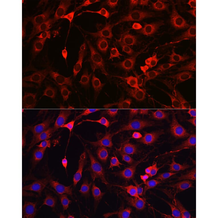 Immunofluorescence - Anti-HMGCR Antibody (A13564) - Antibodies.com