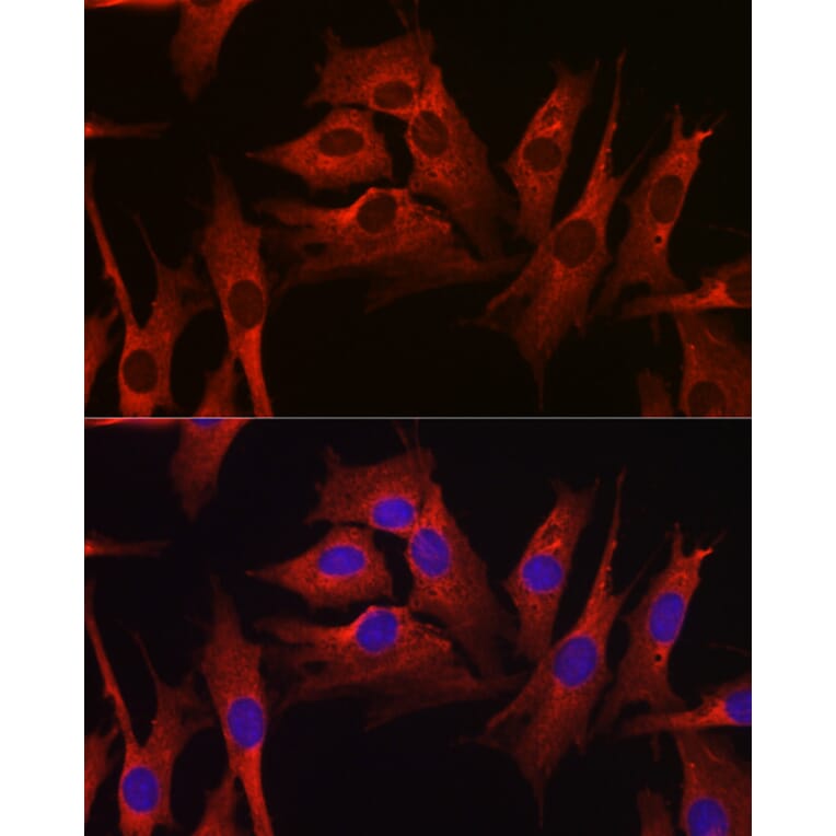 Immunofluorescence - Anti-HMGCR Antibody (A13564) - Antibodies.com