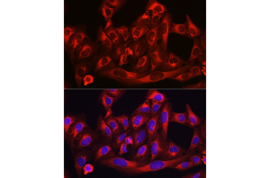 Immunofluorescence - Anti-HMGCR Antibody (A13564) - Antibodies.com