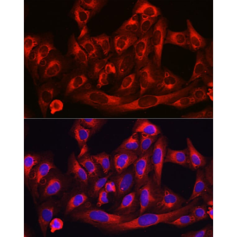 Immunofluorescence - Anti-HMGCR Antibody (A13564) - Antibodies.com