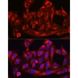 Immunofluorescence - Anti-HMGCR Antibody (A13564) - Antibodies.com