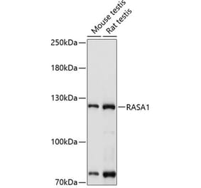 Western Blot - Anti-RASA1 Antibody (A13565) - Antibodies.com