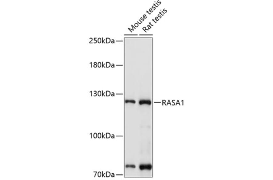 Western Blot - Anti-RASA1 Antibody (A13565) - Antibodies.com