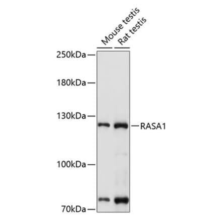 Western Blot - Anti-RASA1 Antibody (A13565) - Antibodies.com