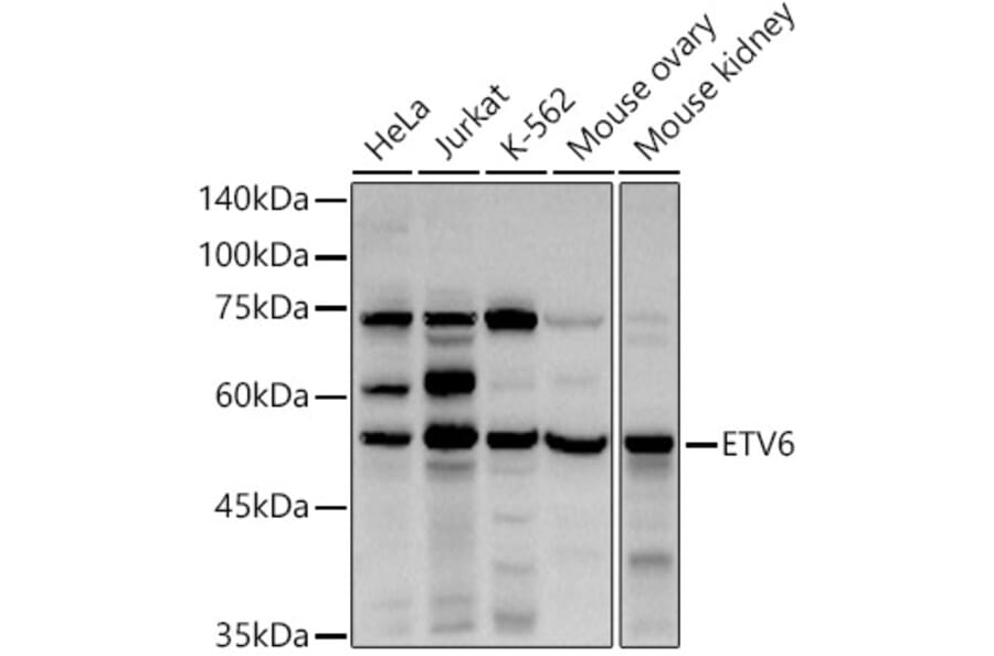 Western Blot - Anti-ETV6/Tel Antibody (A13566) - Antibodies.com