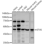Western Blot - Anti-ETV6/Tel Antibody (A13566) - Antibodies.com