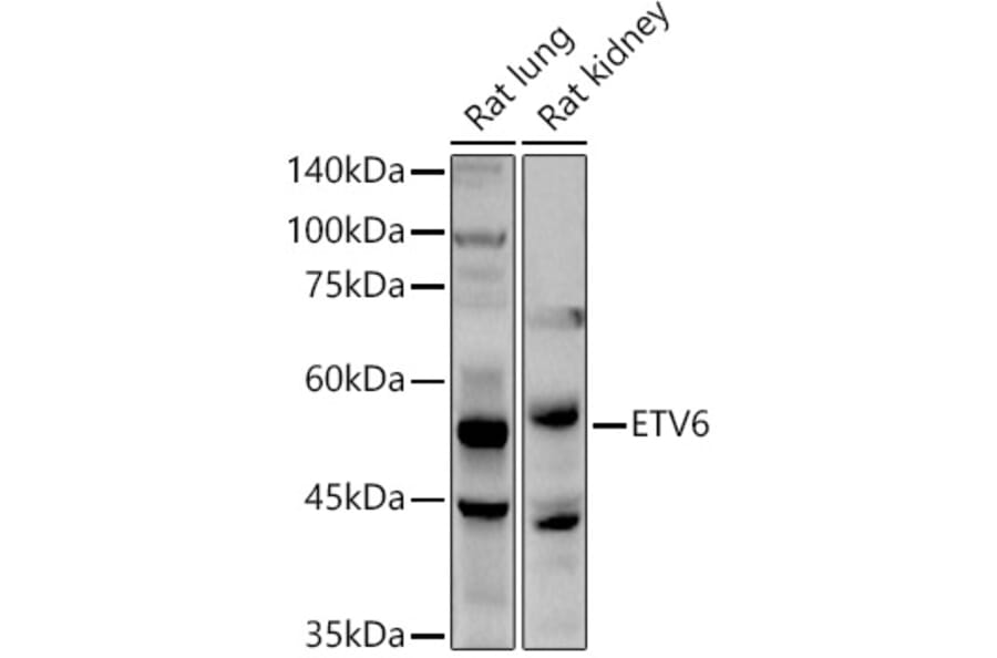 Western Blot - Anti-ETV6/Tel Antibody (A13566) - Antibodies.com