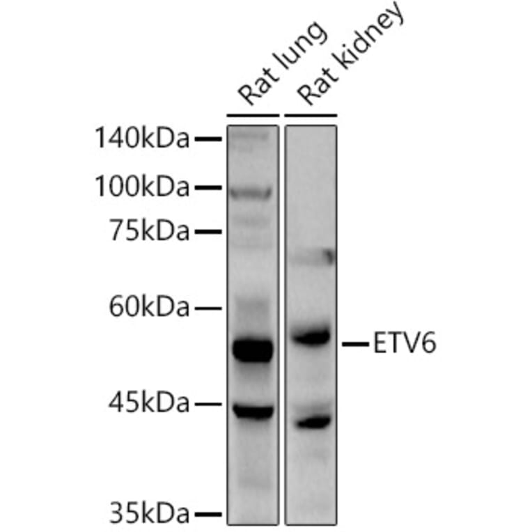 Western Blot - Anti-ETV6/Tel Antibody (A13566) - Antibodies.com