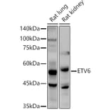 Western Blot - Anti-ETV6/Tel Antibody (A13566) - Antibodies.com