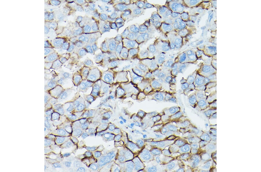 Immunohistochemistry - Anti-delta 1 Catenin/CAS Antibody (A13568) - Antibodies.com