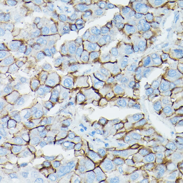 Immunohistochemistry - Anti-delta 1 Catenin/CAS Antibody (A13568) - Antibodies.com
