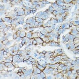 Immunohistochemistry - Anti-delta 1 Catenin/CAS Antibody (A13568) - Antibodies.com
