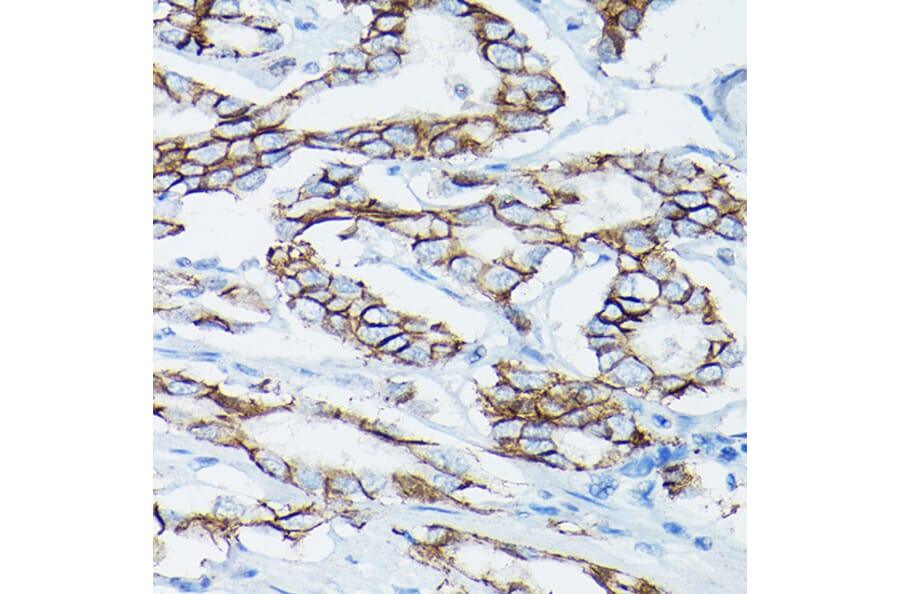 Immunohistochemistry - Anti-delta 1 Catenin/CAS Antibody (A13568) - Antibodies.com