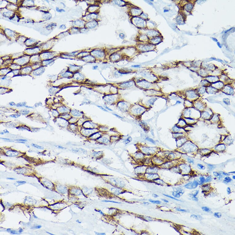 Immunohistochemistry - Anti-delta 1 Catenin/CAS Antibody (A13568) - Antibodies.com
