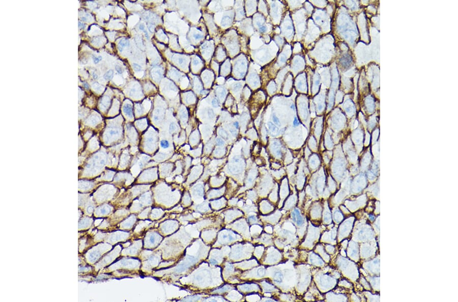 Immunohistochemistry - Anti-delta 1 Catenin/CAS Antibody (A13568) - Antibodies.com