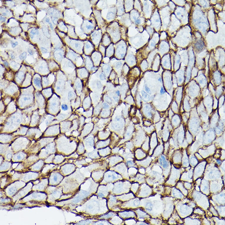 Immunohistochemistry - Anti-delta 1 Catenin/CAS Antibody (A13568) - Antibodies.com