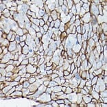 Immunohistochemistry - Anti-delta 1 Catenin/CAS Antibody (A13568) - Antibodies.com