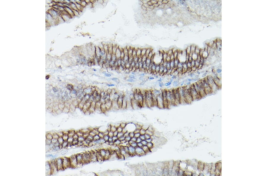 Immunohistochemistry - Anti-delta 1 Catenin/CAS Antibody (A13568) - Antibodies.com