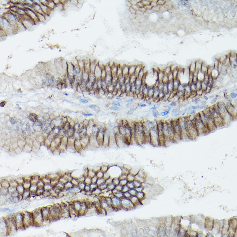 Immunohistochemistry - Anti-delta 1 Catenin/CAS Antibody (A13568) - Antibodies.com