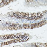 Immunohistochemistry - Anti-delta 1 Catenin/CAS Antibody (A13568) - Antibodies.com