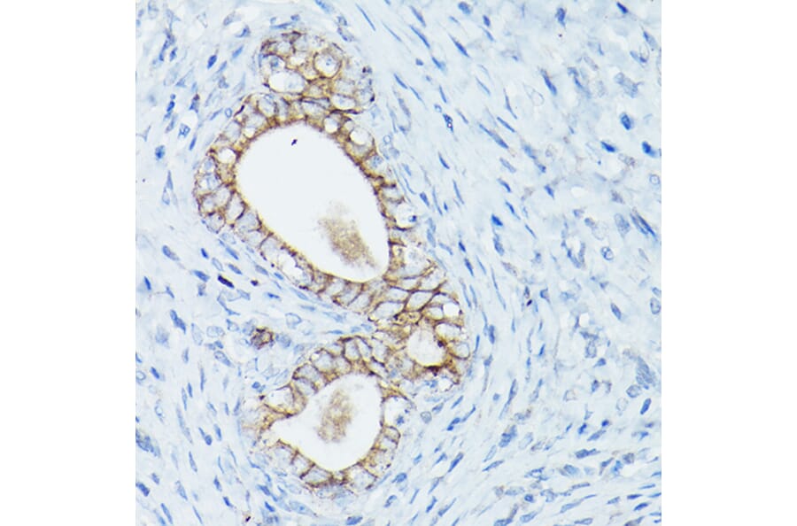 Immunohistochemistry - Anti-delta 1 Catenin/CAS Antibody (A13568) - Antibodies.com