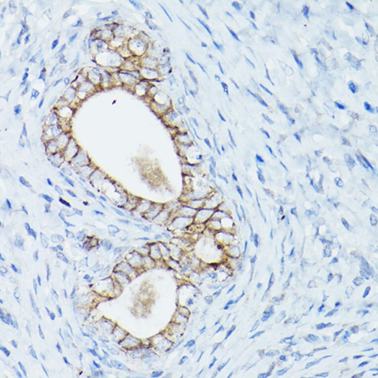 Immunohistochemistry - Anti-delta 1 Catenin/CAS Antibody (A13568) - Antibodies.com