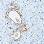 Immunohistochemistry - Anti-delta 1 Catenin/CAS Antibody (A13568) - Antibodies.com