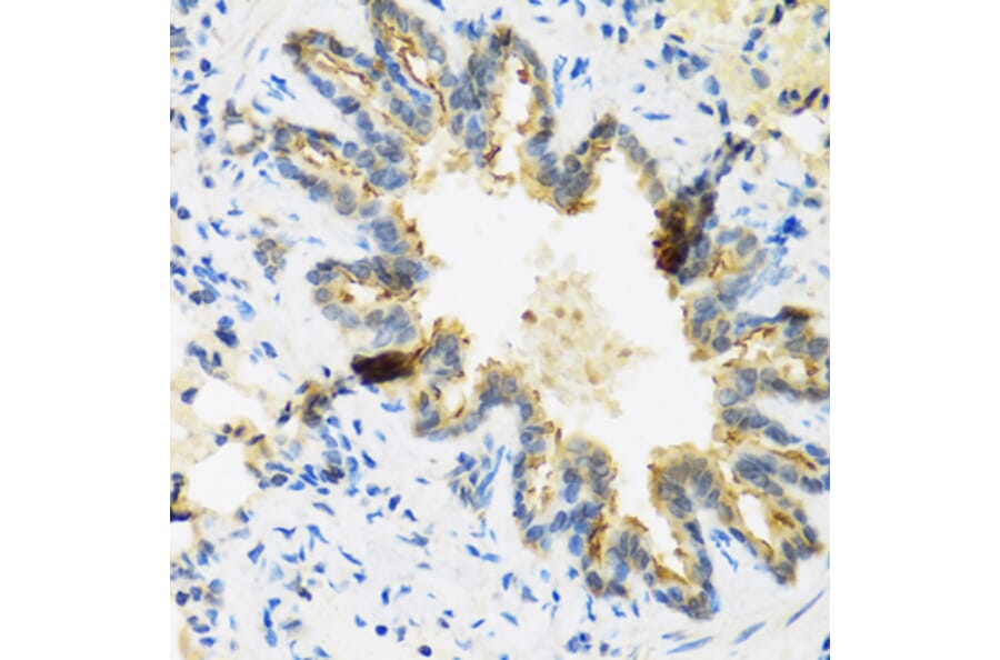 Immunohistochemistry - Anti-beta 2 Defensin/BD-2 Antibody (A13569) - Antibodies.com