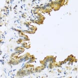 Immunohistochemistry - Anti-beta 2 Defensin/BD-2 Antibody (A13569) - Antibodies.com